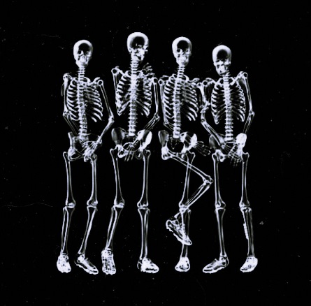 X-RAY #16 - FUNNY X-RAY | OpenSea X-RAY #16 - FUNNY X-RAY | OpenSea