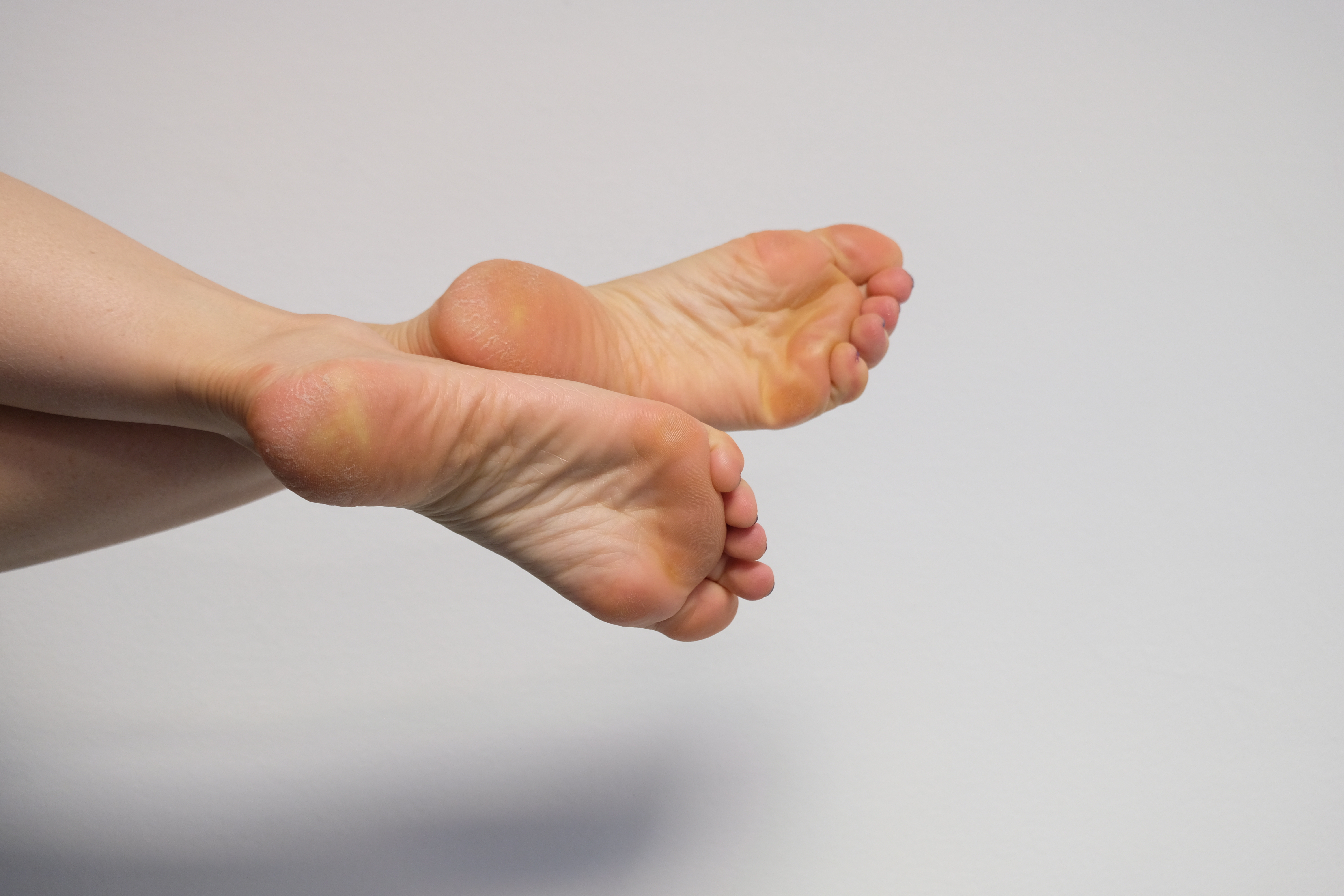 Female feet soles - CryptoFeet